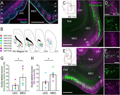 Entorhinal Layer II Calbindin-Expressing Neurons Originate Widespread Telencephalic and Intrinsic Projections